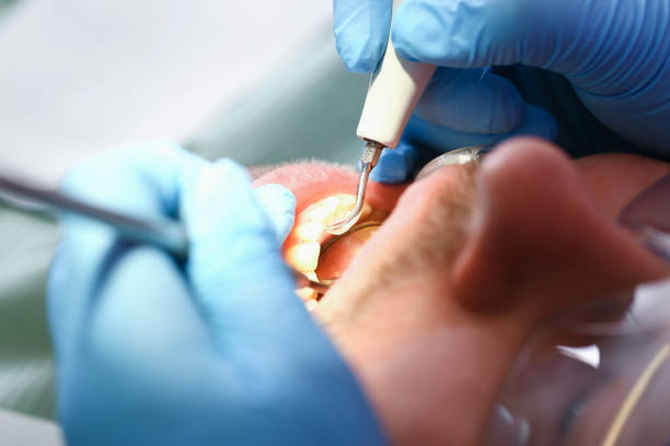 Best Emergency Root Canal Treatment in Pleasureville, PA